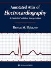 Annotated Atlas of Electrocardiography : A Guide to Confident Interpretation - Book