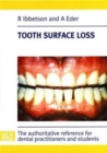 Tooth Surface Loss - Book