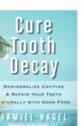 Cure Tooth Decay : Remineralize Cavities and Repair Your Teeth Naturally with Good Food - Book