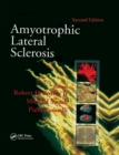 Amyotrophic Lateral Sclerosis, Second Edition - eBook