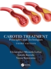 Carotid Treatment: Principles and Techniques - eBook