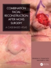 Combination Facial Reconstruction after Mohs Surgery : A Case Based Atlas - eBook