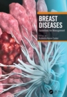 Breast Diseases : Guidelines for Management - eBook