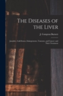 The Diseases of the Liver : Jaundice, Gall-stones, Enlargements, Tumours, and Cancer: and Their Treatment - Book