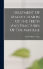 Treatment Of Malocculsion Of The Teeth And Fractures Of The Maxillæ - Book