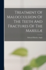 Treatment Of Malocculsion Of The Teeth And Fractures Of The Maxillæ - Book