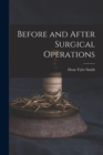 Before and After Surgical Operations - Book
