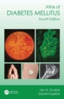 Atlas of Diabetes Mellitus - Book