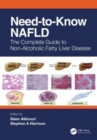 Need-to-Know NAFLD : The Complete Guide to Nonalcoholic Fatty Liver Disease - Book