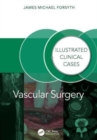 Vascular Surgery: : Illustrated Clinical Cases - Book