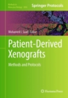 Patient-Derived Xenografts : Methods and Protocols - Book