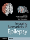 Imaging Biomarkers in Epilepsy - eBook