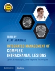 Integrated Management of Complex Intracranial Lesions Hardback Set and Static Online Product : Open, Endoscopic, and Keyhole Techniques - Book