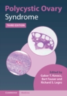 Polycystic Ovary Syndrome - eBook