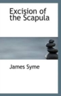 Excision of the Scapula - Book