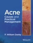 Acne : Causes and Practical Management - Book