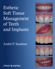 Esthetic Soft Tissue Management of Teeth and Implants - Book