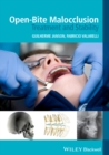 Open-Bite Malocclusion : Treatment and Stability - Book