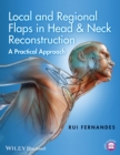 Local and Regional Flaps in Head and Neck Reconstruction : A Practical Approach - Book