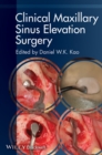 Clinical Maxillary Sinus Elevation Surgery - eBook