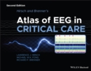 Hirsch and Brenner's Atlas of EEG in Critical Care - Book