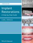 Implant Restorations : A Step-by-Step Guide - eBook