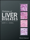 Pathology of Liver Diseases - Book