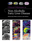 Clinical Dilemmas in Non-Alcoholic Fatty Liver Disease - eBook