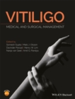 Vitiligo : Medical and Surgical Management - Book