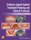 Evidence-based Implant Treatment Planning and Clinical Protocols - Book