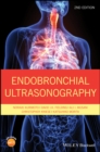 Endobronchial Ultrasonography - Book
