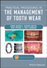 Practical Procedures in the Management of Tooth Wear - eBook