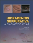 Hidradenitis Suppurativa : A Diagnostic Atlas - eBook