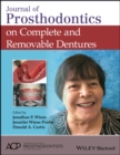 Journal of Prosthodontics on Complete and Removable Dentures - Book