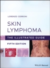 Skin Lymphoma : The Illustrated Guide - Book