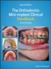 The Orthodontic Mini-implant Clinical Handbook - eBook