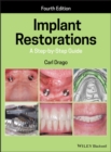 Implant Restorations : A Step-by-Step Guide - Book
