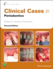 Clinical Cases in Periodontics - Book