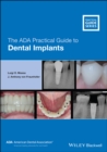 The ADA Practical Guide to Dental Implants - Book