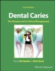 Dental Caries : The Disease and its Clinical Management - Book
