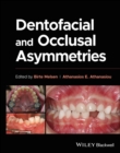 Dentofacial and Occlusal Asymmetries - Book