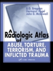 A Radiologic Atlas of Abuse, Torture, Terrorism, and Inflicted Trauma - eBook