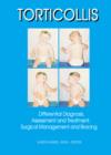 Torticollis : Differential Diagnosis, Assessment and Treatment, Surgical Management and Bracing - eBook