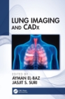 Lung Imaging and CADx - Book