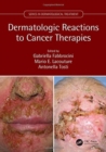 Dermatologic Reactions to Cancer Therapies - Book