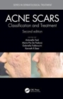 Acne Scars : Classification and Treatment, Second Edition - Book