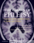 Causes of Epilepsy : Common and Uncommon Causes in Adults and Children - eBook