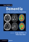 Case Studies in Dementia: Volume 1 : Common and Uncommon Presentations - eBook