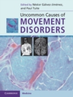 Uncommon Causes of Movement Disorders - eBook