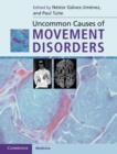 Uncommon Causes of Movement Disorders - eBook